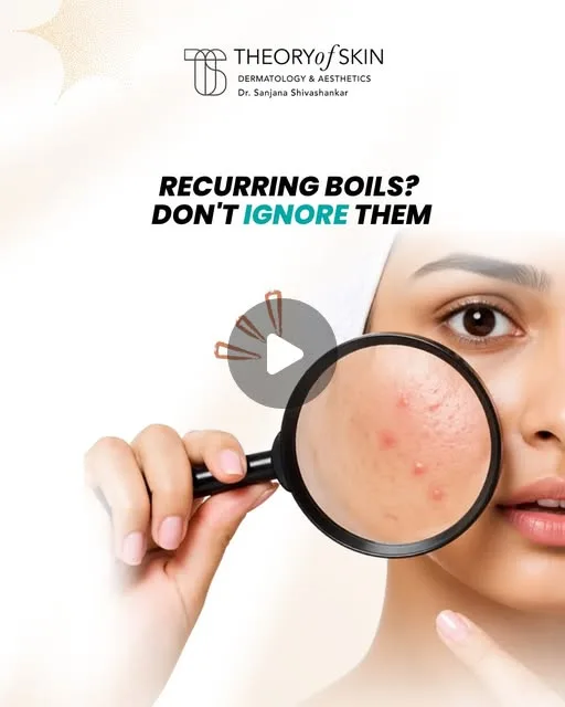 Recurring boils reel from Theory of Skin, Indiranagar